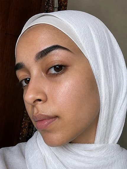 صورة المقارنة بعد استخدام Spotless+